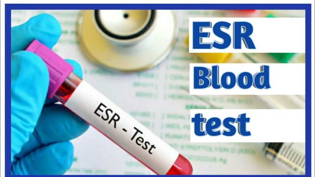 What Is The Full Form Of Esr Test